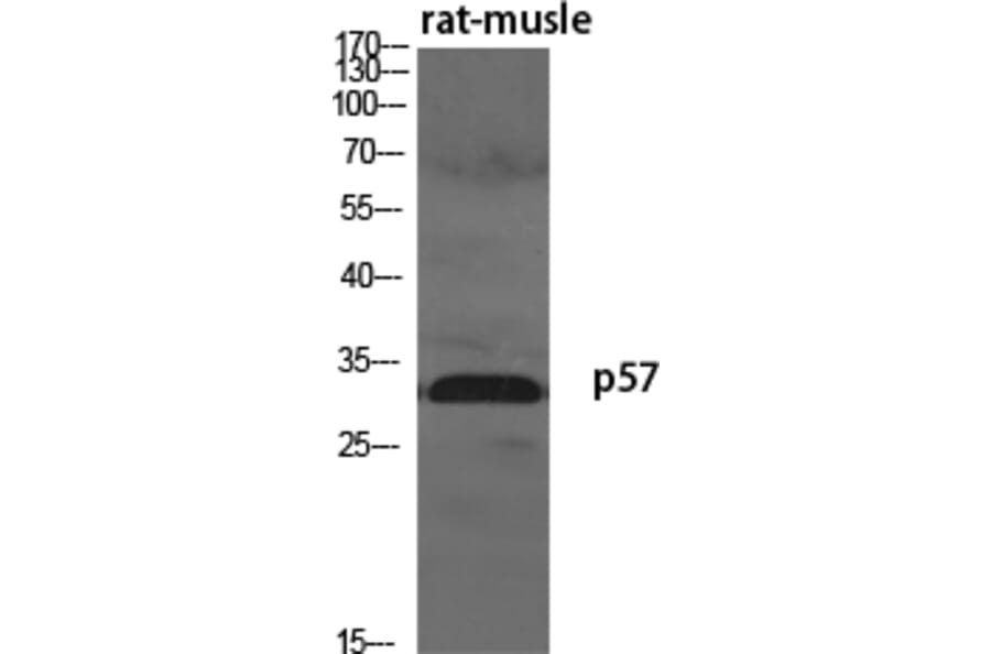 Western Blot - Anti-p57KIP2 Antibody (C10659) - Antibodies.com