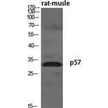 Western Blot - Anti-p57KIP2 Antibody (C10659) - Antibodies.com