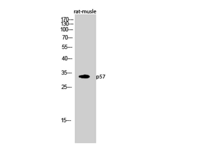 Western Blot - Anti-p57KIP2 Antibody (C10659) - Antibodies.com