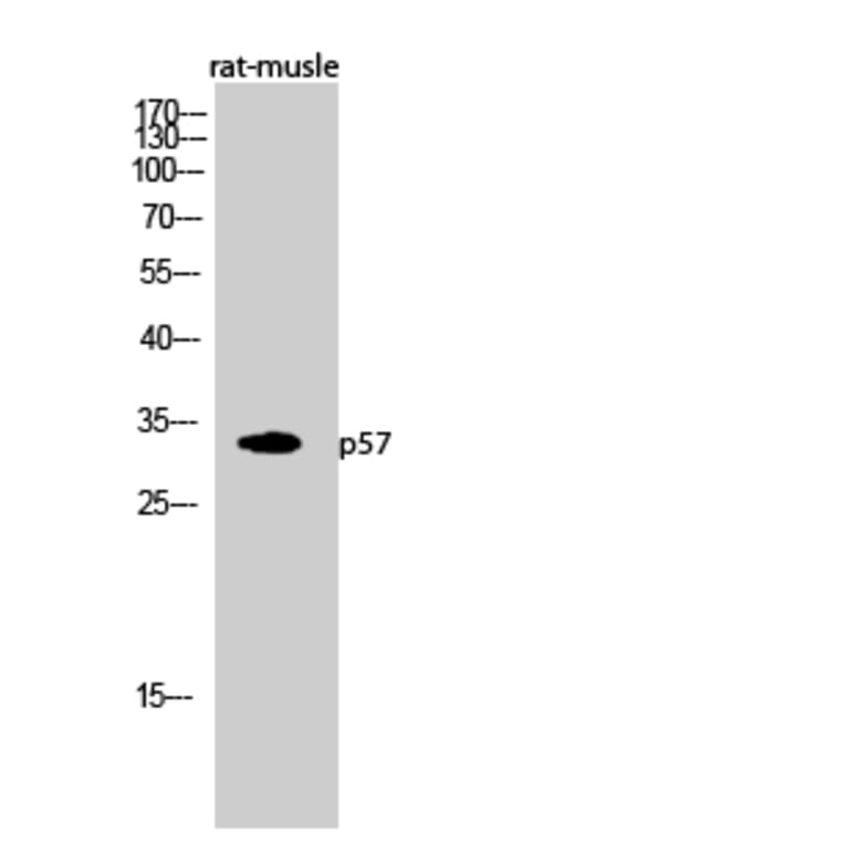 Western Blot - Anti-p57KIP2 Antibody (C10659) - Antibodies.com