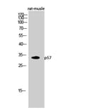 Western Blot - Anti-p57KIP2 Antibody (C10659) - Antibodies.com