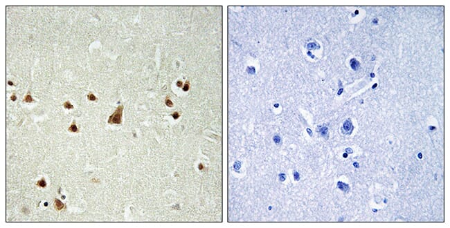 Immunohistochemical analysis of paraffin-embedded human brain using Anti-ANKRD26 Antibody. The right hand panel represents a negative control, where the antibody was pre-incubated with the immunising peptide.
