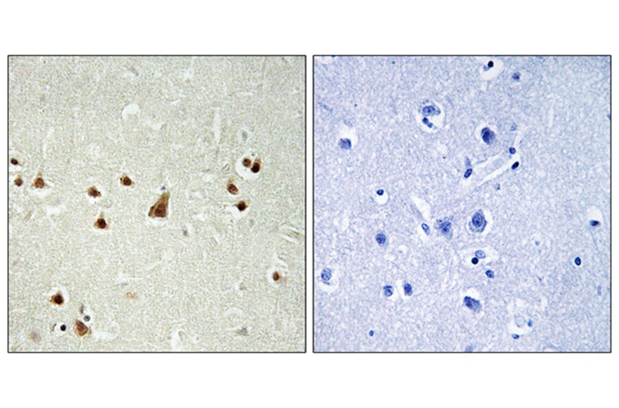 Immunohistochemistry - Anti-ANKRD26 Antibody (C14497) - Antibodies.com