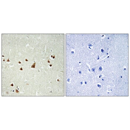 Immunohistochemistry - Anti-ANKRD26 Antibody (C14497) - Antibodies.com