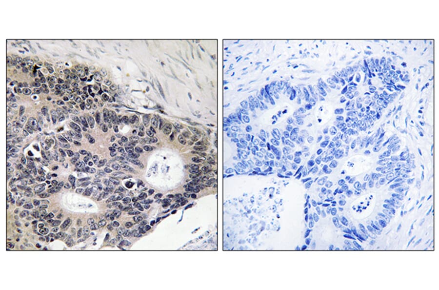 Immunohistochemistry - Anti-ABHD12B Antibody (C14210) - Antibodies.com