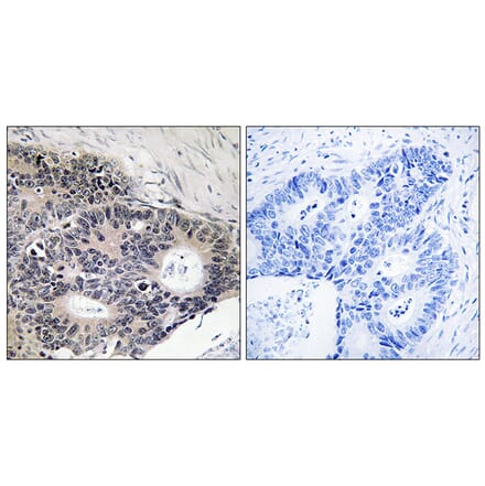 Immunohistochemistry - Anti-ABHD12B Antibody (C14210) - Antibodies.com