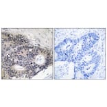 Immunohistochemistry - Anti-ABHD12B Antibody (C14210) - Antibodies.com