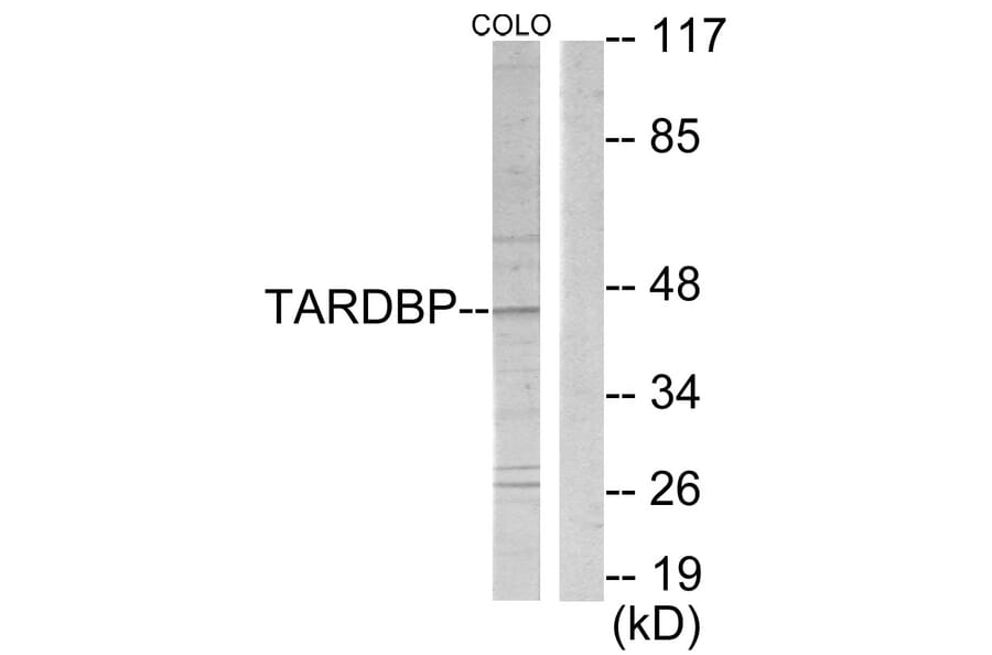 Western Blot - Anti-TBX1 Antibody (C10102) - Antibodies.com