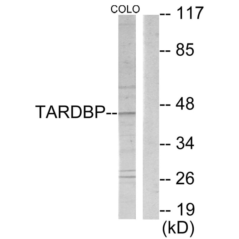 Western Blot - Anti-TBX1 Antibody (C10102) - Antibodies.com