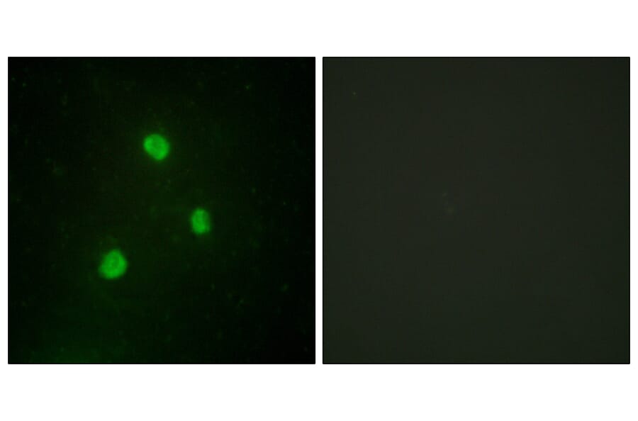Immunofluorescence - Anti-TBX1 Antibody (C10102) - Antibodies.com