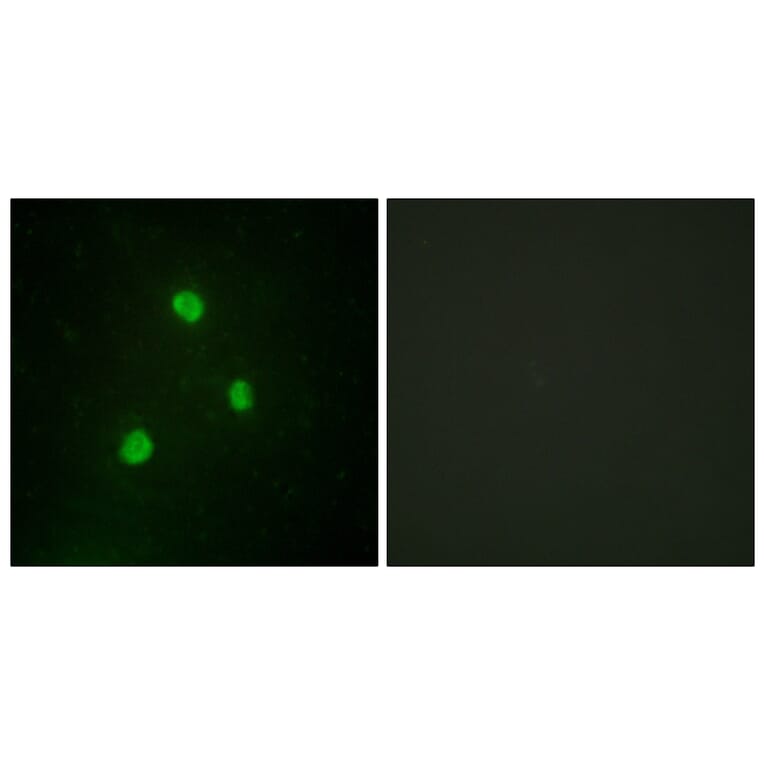 Immunofluorescence - Anti-TBX1 Antibody (C10102) - Antibodies.com