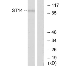 Western Blot - Anti-ST14 Antibody (C11979) - Antibodies.com