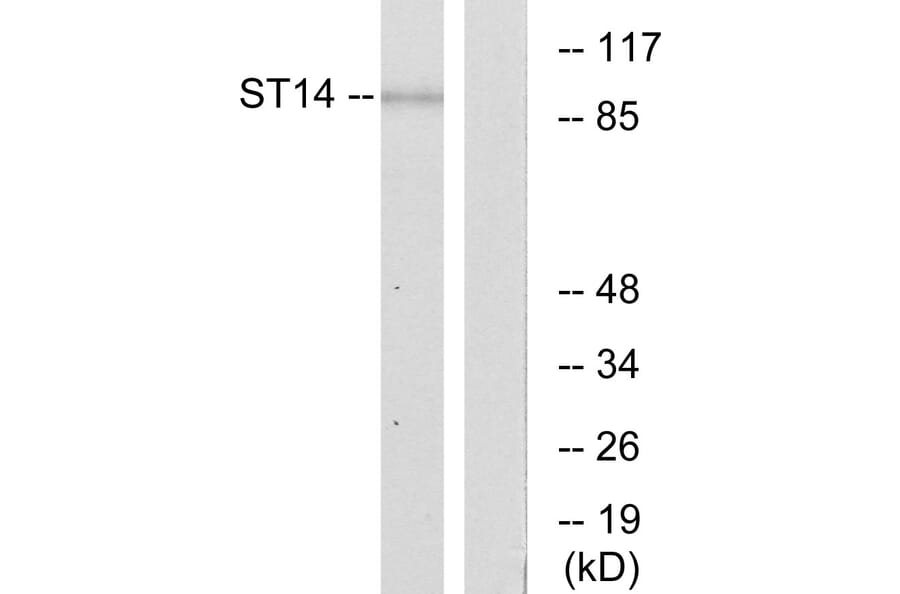 Western Blot - Anti-ST14 Antibody (C11979) - Antibodies.com
