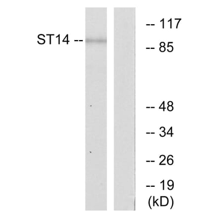 Western Blot - Anti-ST14 Antibody (C11979) - Antibodies.com