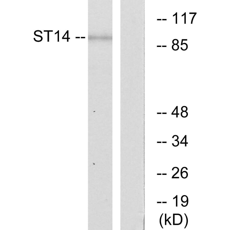 Western Blot - Anti-ST14 Antibody (C11979) - Antibodies.com