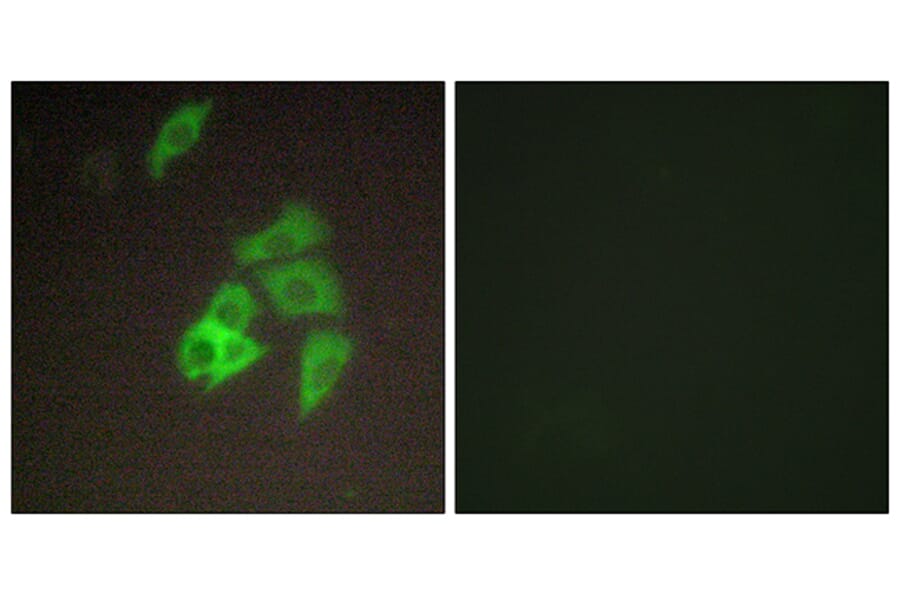 Immunofluorescence - Anti-ST14 Antibody (C11979) - Antibodies.com