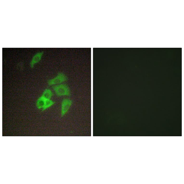 Immunofluorescence - Anti-ST14 Antibody (C11979) - Antibodies.com