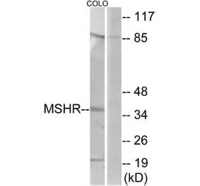 Western Blot - Anti-MSHR Antibody (G396) - Antibodies.com