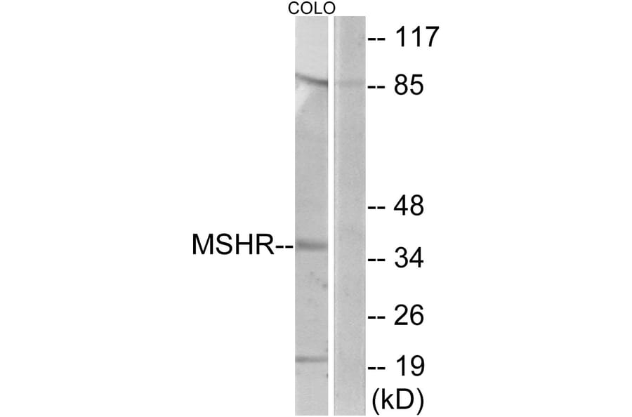 Western Blot - Anti-MSHR Antibody (G396) - Antibodies.com