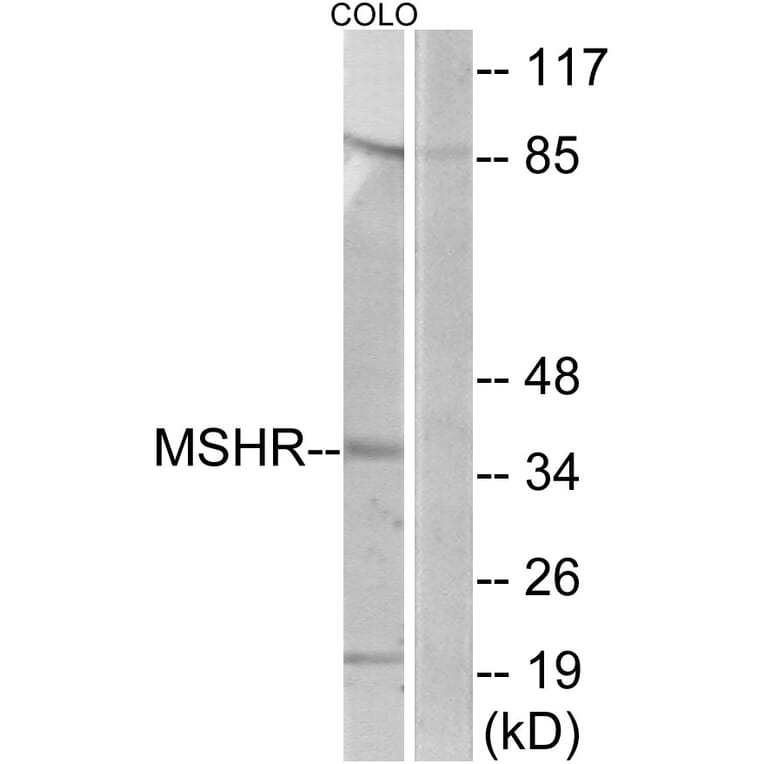 Western Blot - Anti-MSHR Antibody (G396) - Antibodies.com