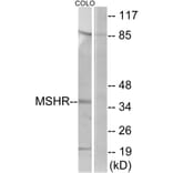 Western Blot - Anti-MSHR Antibody (G396) - Antibodies.com