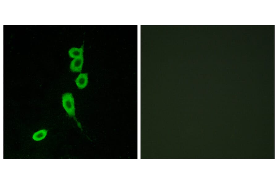 Immunofluorescence - Anti-MSHR Antibody (G396) - Antibodies.com