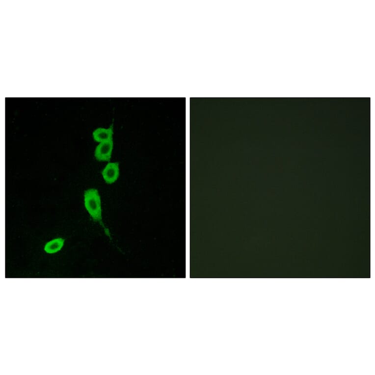 Immunofluorescence - Anti-MSHR Antibody (G396) - Antibodies.com