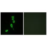 Immunofluorescence - Anti-MSHR Antibody (G396) - Antibodies.com