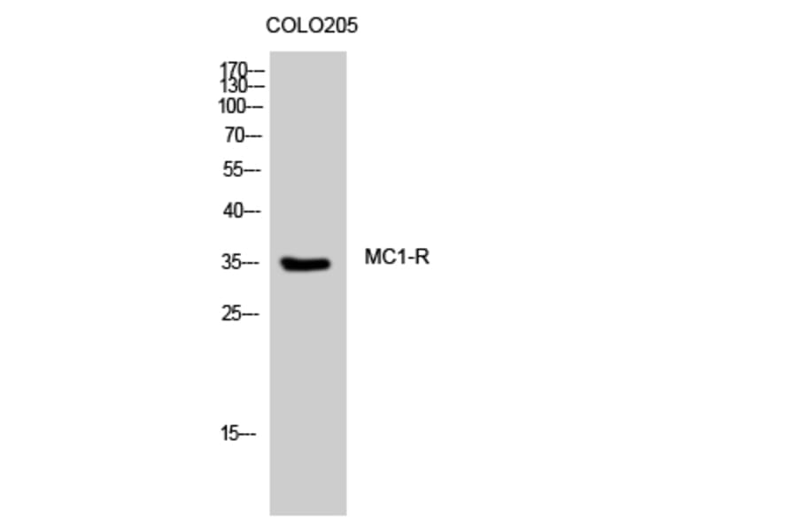 Western Blot - Anti-MSHR Antibody (G396) - Antibodies.com