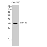 Western Blot - Anti-MSHR Antibody (G396) - Antibodies.com