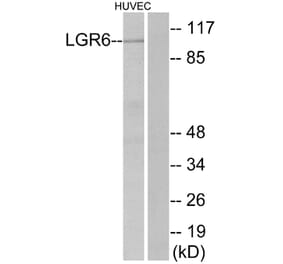 Western Blot - Anti-LGR6 Antibody (G376) - Antibodies.com