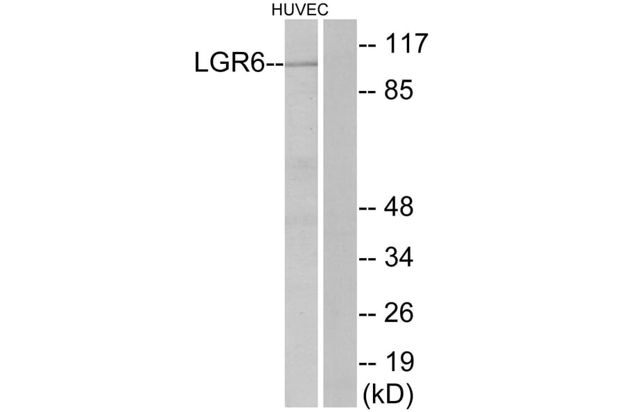 Western Blot - Anti-LGR6 Antibody (G376) - Antibodies.com