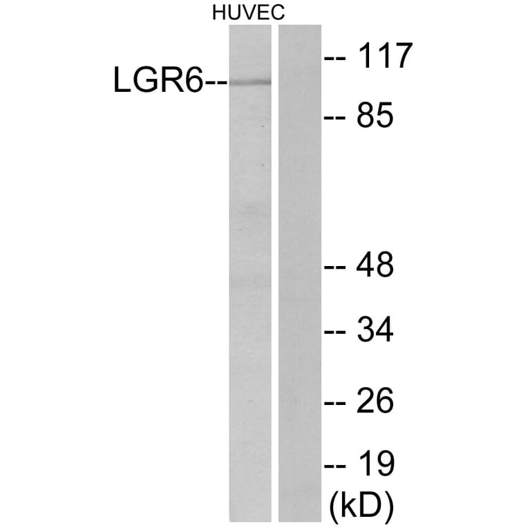 Western Blot - Anti-LGR6 Antibody (G376) - Antibodies.com