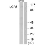 Western Blot - Anti-LGR6 Antibody (G376) - Antibodies.com