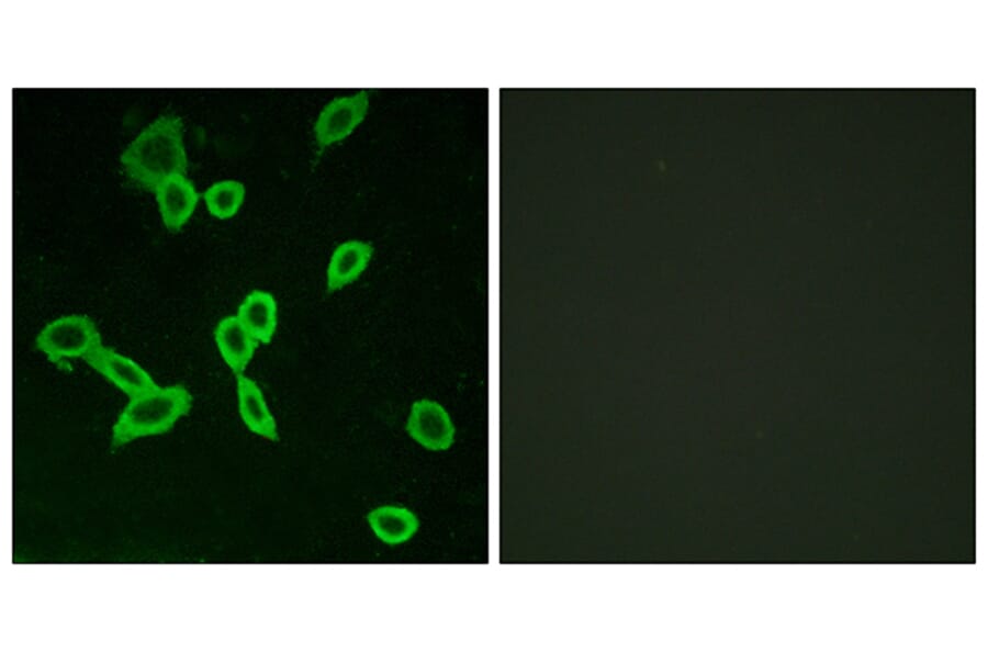Immunofluorescence - Anti-LGR6 Antibody (G376) - Antibodies.com