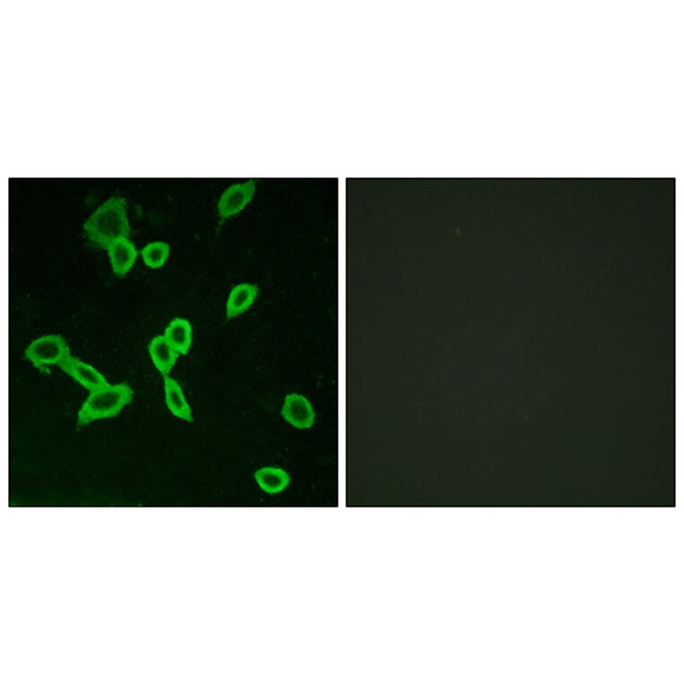 Immunofluorescence - Anti-LGR6 Antibody (G376) - Antibodies.com