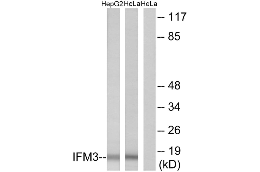 Western Blot - Anti-IFM3 Antibody (C12462) - Antibodies.com