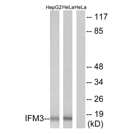 Western Blot - Anti-IFM3 Antibody (C12462) - Antibodies.com