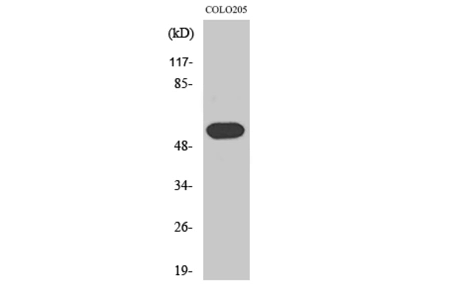 Western Blot - Anti-HRH1 Antibody (G369) - Antibodies.com