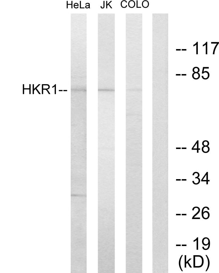 Western blot analysis of lysates from HeLa, Jurkat, and COLO205 cells using Anti-HKR1 Antibody. The right hand lane represents a negative control, where the antibody is blocked by the immunising peptide.