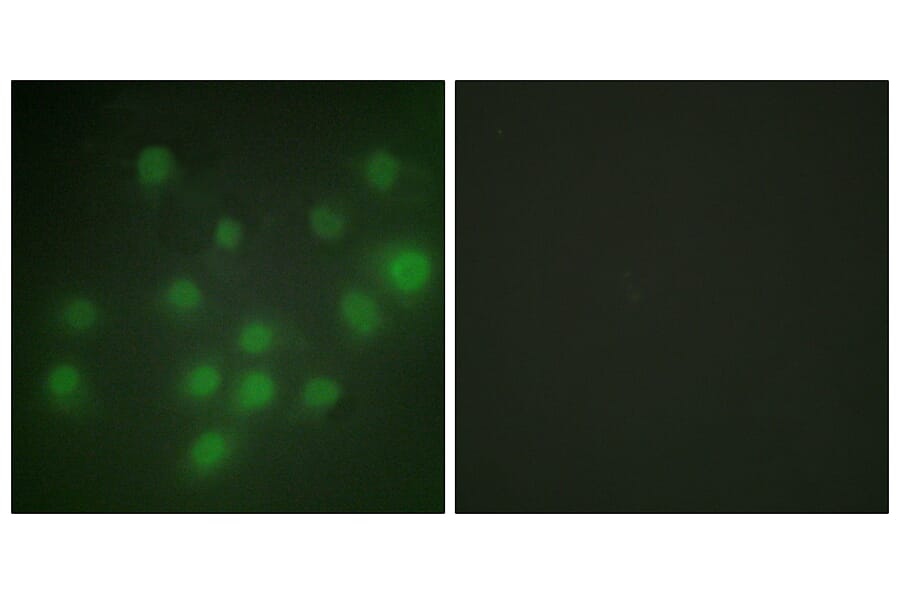 Immunofluorescence - Anti-HKR1 Antibody (C10329) - Antibodies.com
