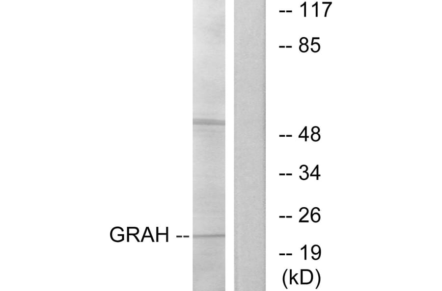 Western Blot - Anti-GRAH Antibody (C13059) - Antibodies.com