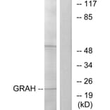 Western Blot - Anti-GRAH Antibody (C13059) - Antibodies.com