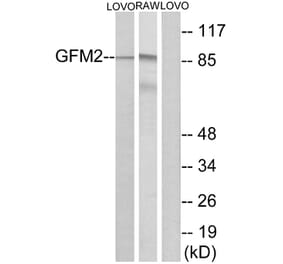 Western Blot - Anti-GFM2 Antibody (C15614) - Antibodies.com