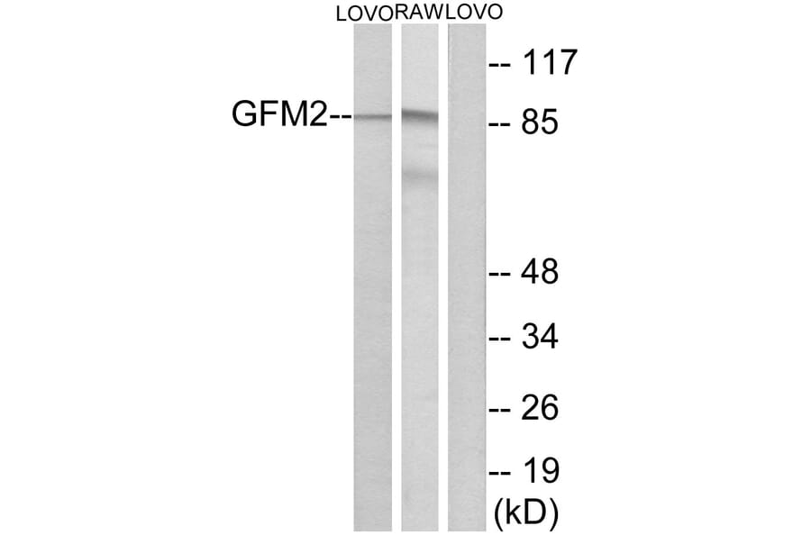 Western Blot - Anti-GFM2 Antibody (C15614) - Antibodies.com