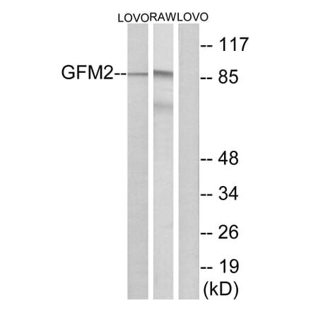 Western Blot - Anti-GFM2 Antibody (C15614) - Antibodies.com