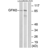Western Blot - Anti-GFM2 Antibody (C15614) - Antibodies.com