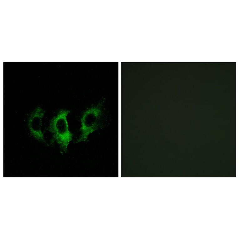 Immunofluorescence - Anti-GFM2 Antibody (C15614) - Antibodies.com
