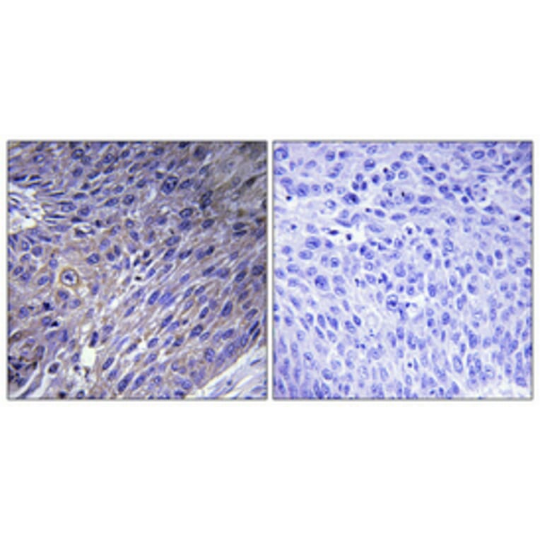Immunohistochemistry - Anti-GFM2 Antibody (C15614) - Antibodies.com
