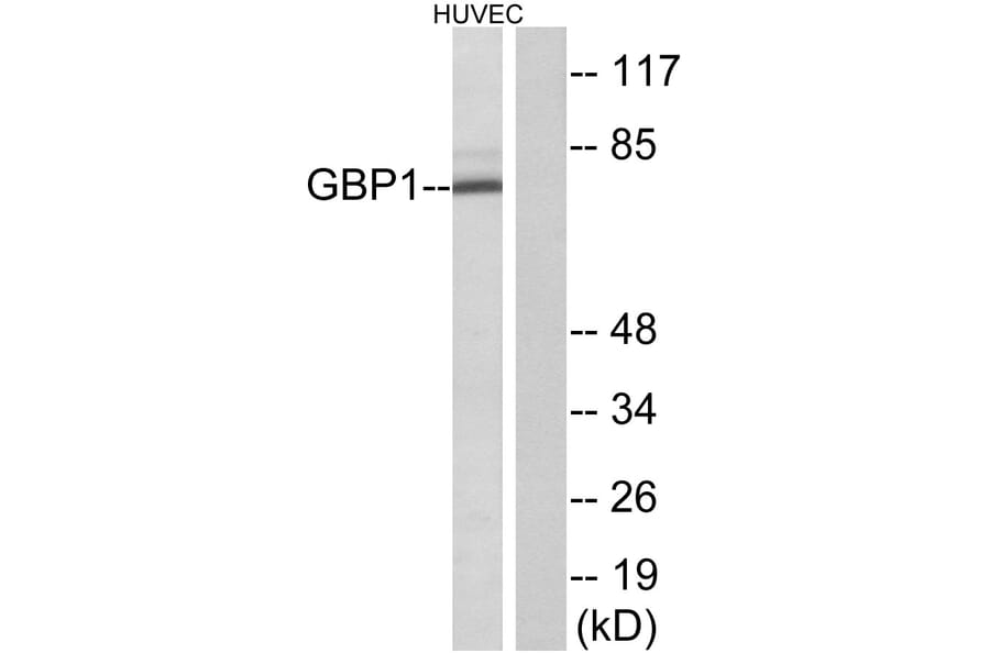 Western Blot - Anti-GBP1 Antibody (C12390) - Antibodies.com